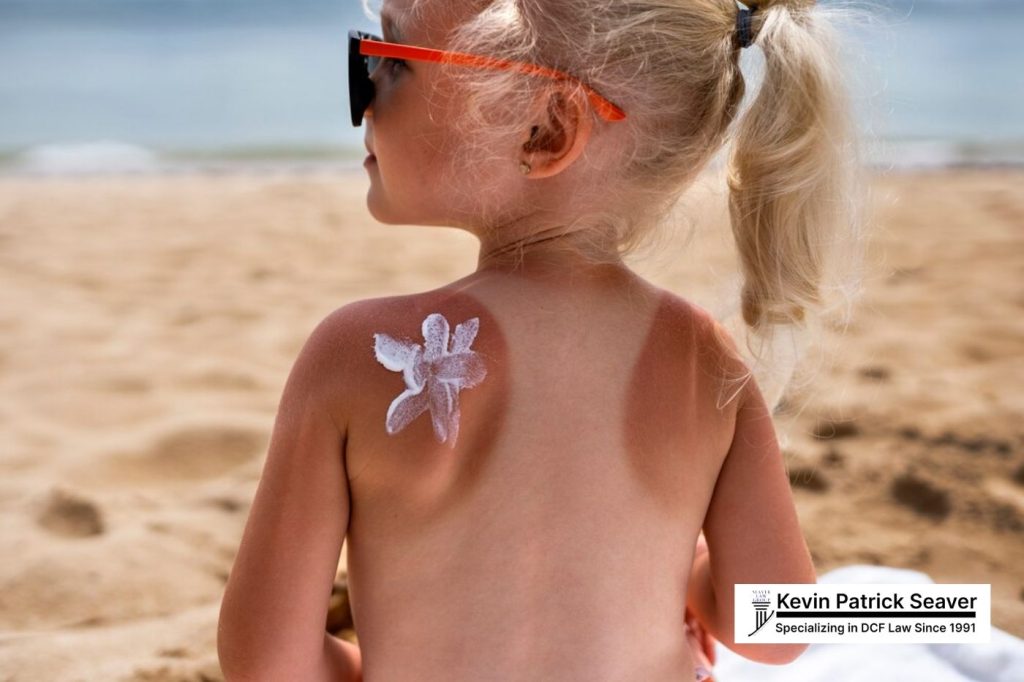 Understanding MA DCF Investigation for Sunburn 16 How a Sunburn Leads to a MA DCF Investigation